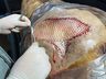 Curso de Medicina Veterinária da Uceff inova no implante de pele de Tilápia em Equino