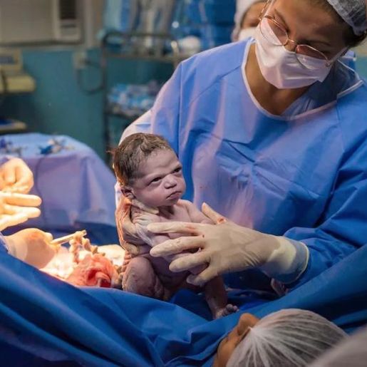 Fotos de bebê que nasceu com cara emburrada fazem sucesso 